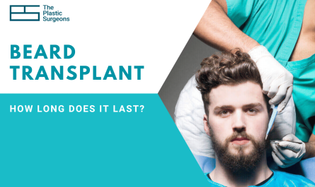 How Long Does Beard Transplant Last?