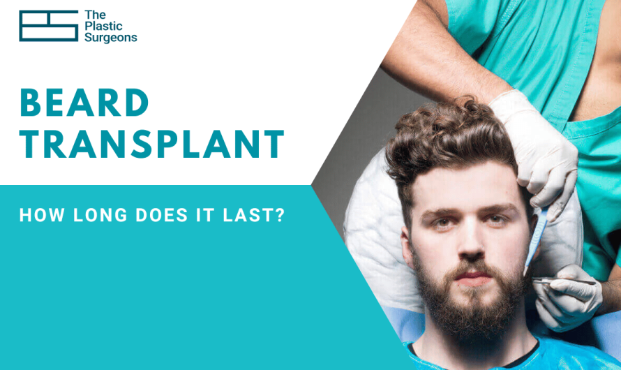 How Long Does Beard Transplant Last?
