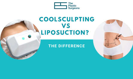 What is the Difference between Coolsculpting and Liposuction?