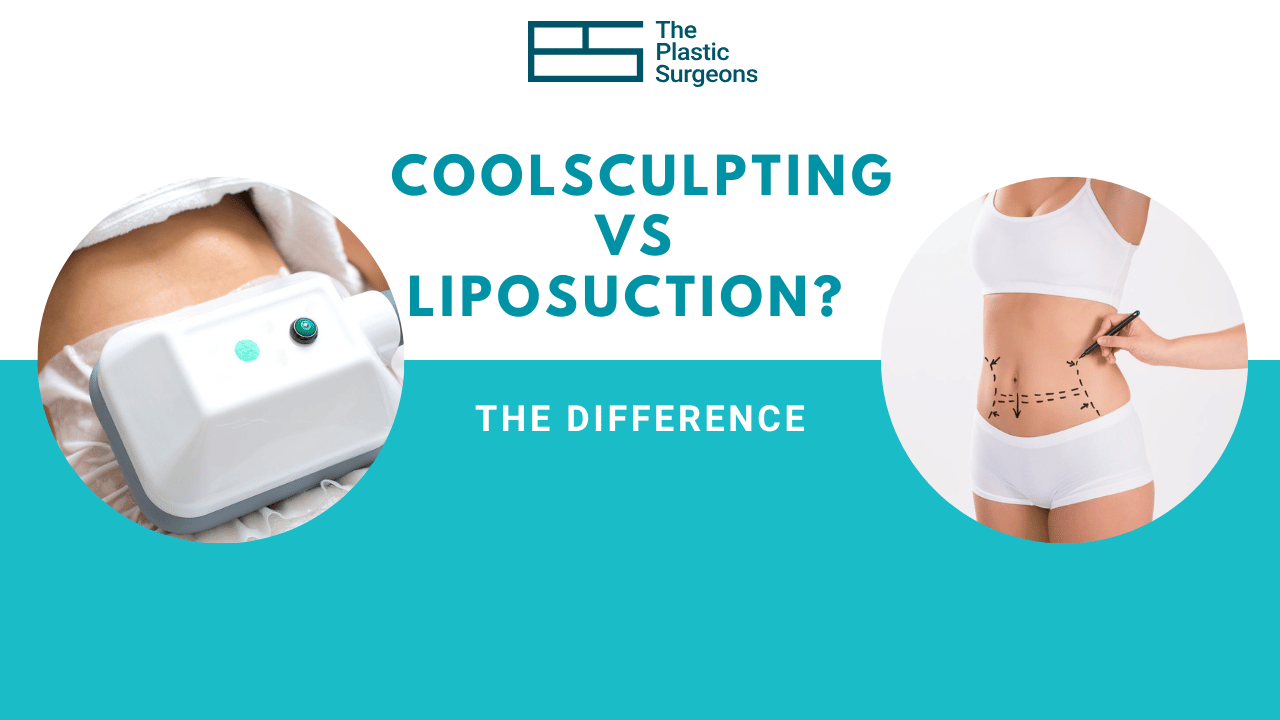 What is the Difference between Coolsculpting and Liposuction?