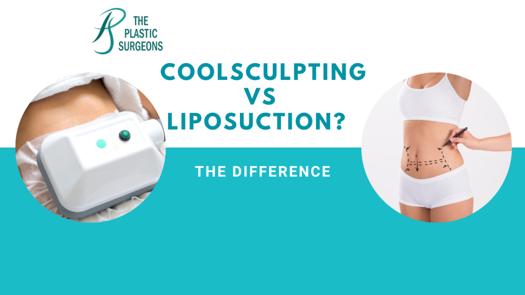 What is the Difference between Coolsculpting and Liposuction? The