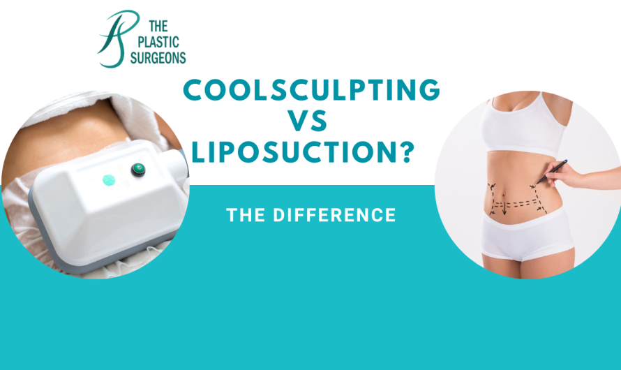 What is the Difference between Coolsculpting and Liposuction?
