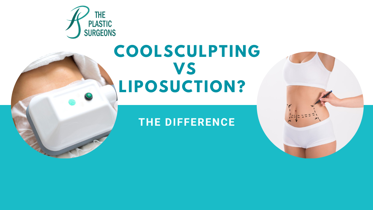 What is the Difference between Coolsculpting and Liposuction