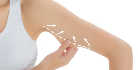 Liposuction for Arms and Thighs: Targeted Fat Removal