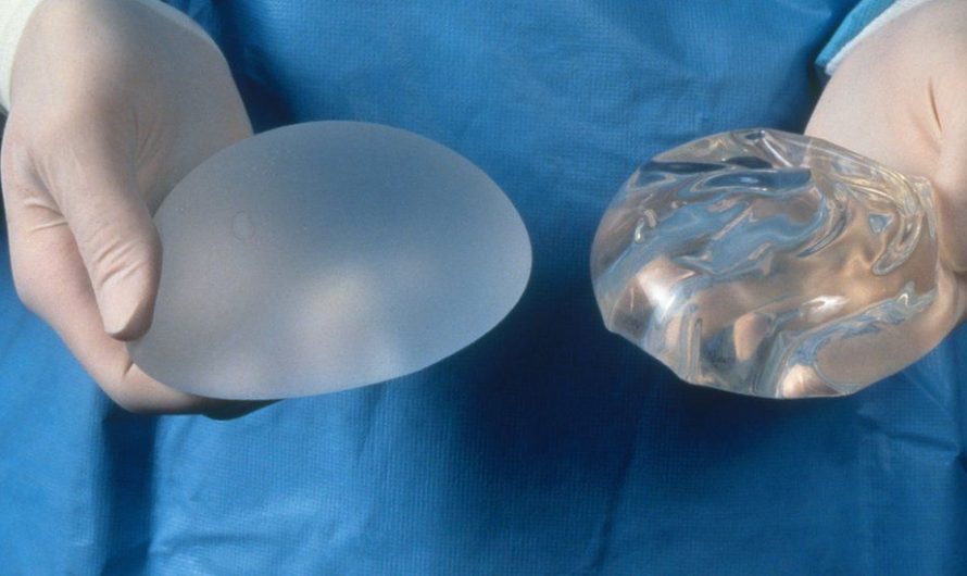 Saline vs. Silicone Implants: Understanding the Differences