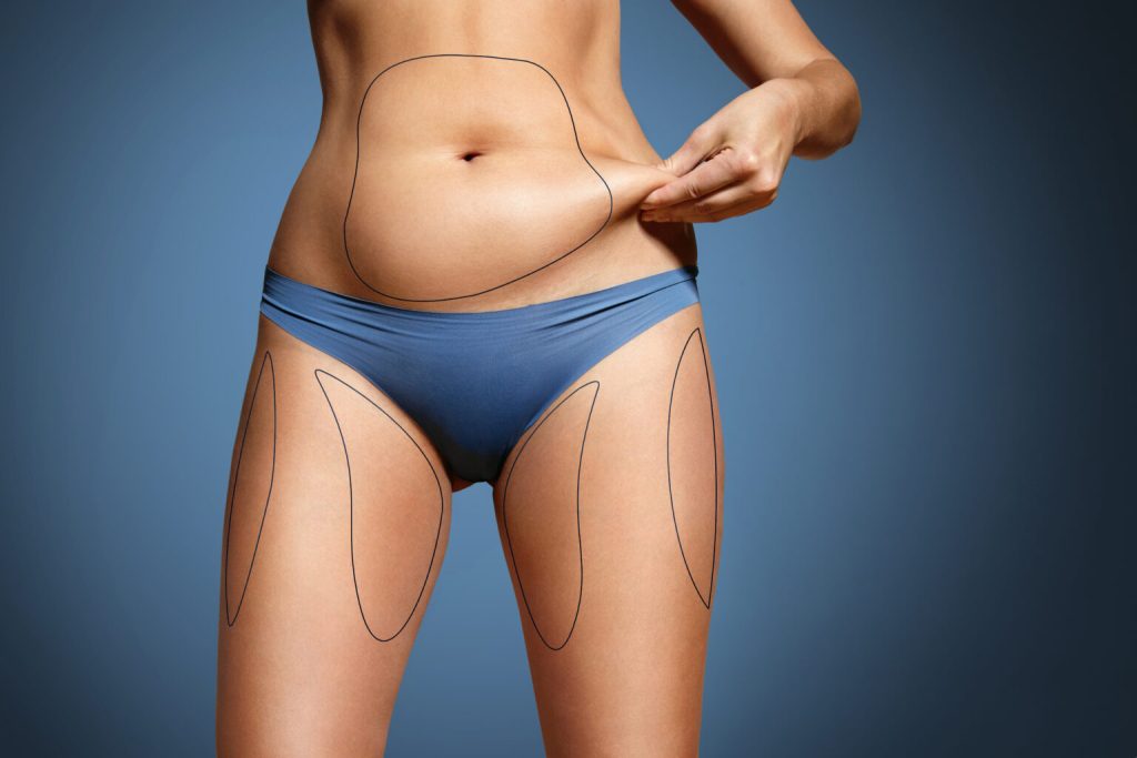 What is the science behind liposuction?
