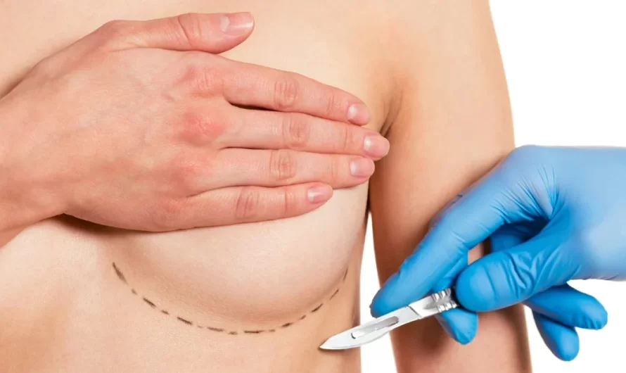 Breast Augmentation Risks and Complications: What to Know