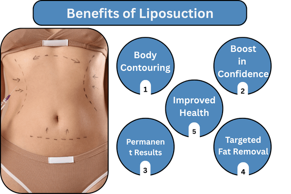 learn Benefits of Liposuction in Mumbai with The Plastic Surgeons