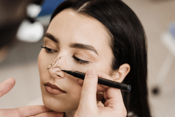 Rhinoplasty Procedure and Cost : Enhance Your Natural Beauty