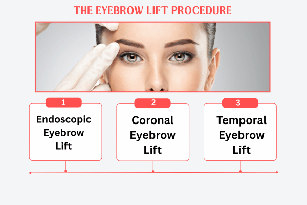 The Eyebrow Lift Procedure in Mumbai with The Plastic surgeon