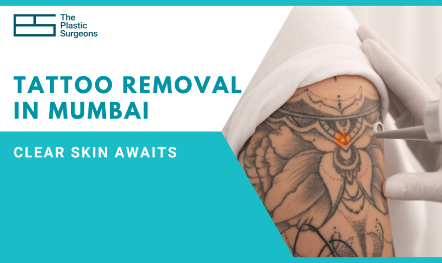Affordable Tattoo Removal in Mumbai: Clear Skin Awaits