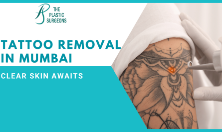 Affordable Tattoo Removal in Mumbai: Clear Skin Awaits