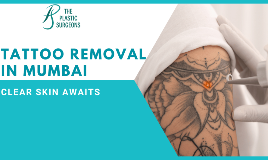 Affordable Tattoo Removal in Mumbai: Clear Skin Awaits