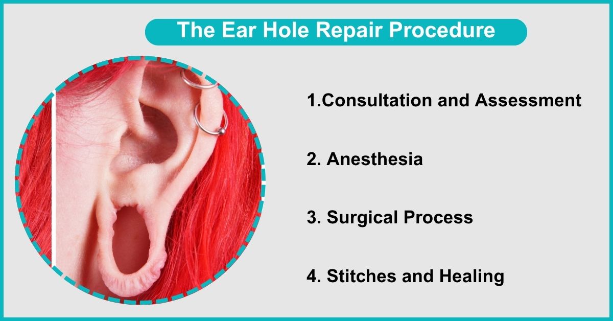 The Ear Hole Repair Procedure in Mumbai at Plastic Surgeons centre
