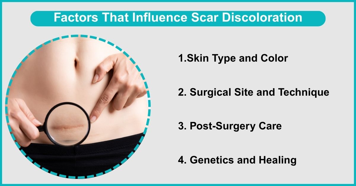 Factors That Influence Scar Discoloration