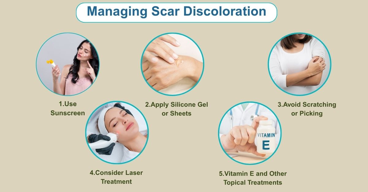 Managing Scar Discoloration in Mumbai with The plastic Surgeons