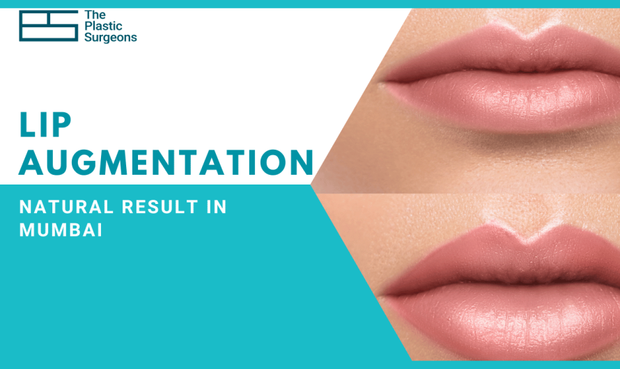 Natural Lip Augmentation Surgery in Mumbai