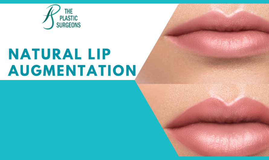 Natural Lip Augmentation Surgery in Mumbai
