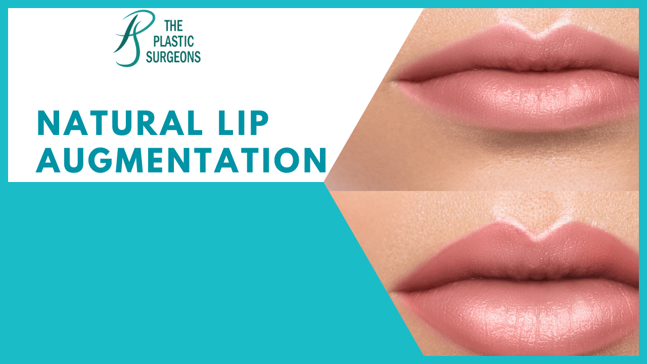 Natural Lip Augmentation Surgery in Mumbai