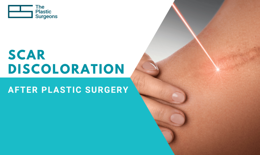 Understanding scar discoloration after plastic surgery