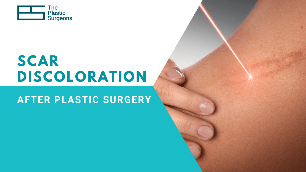 Understanding scar discoloration after plastic surgery
