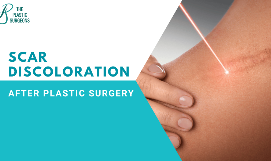 Understanding scar discoloration after plastic surgery
