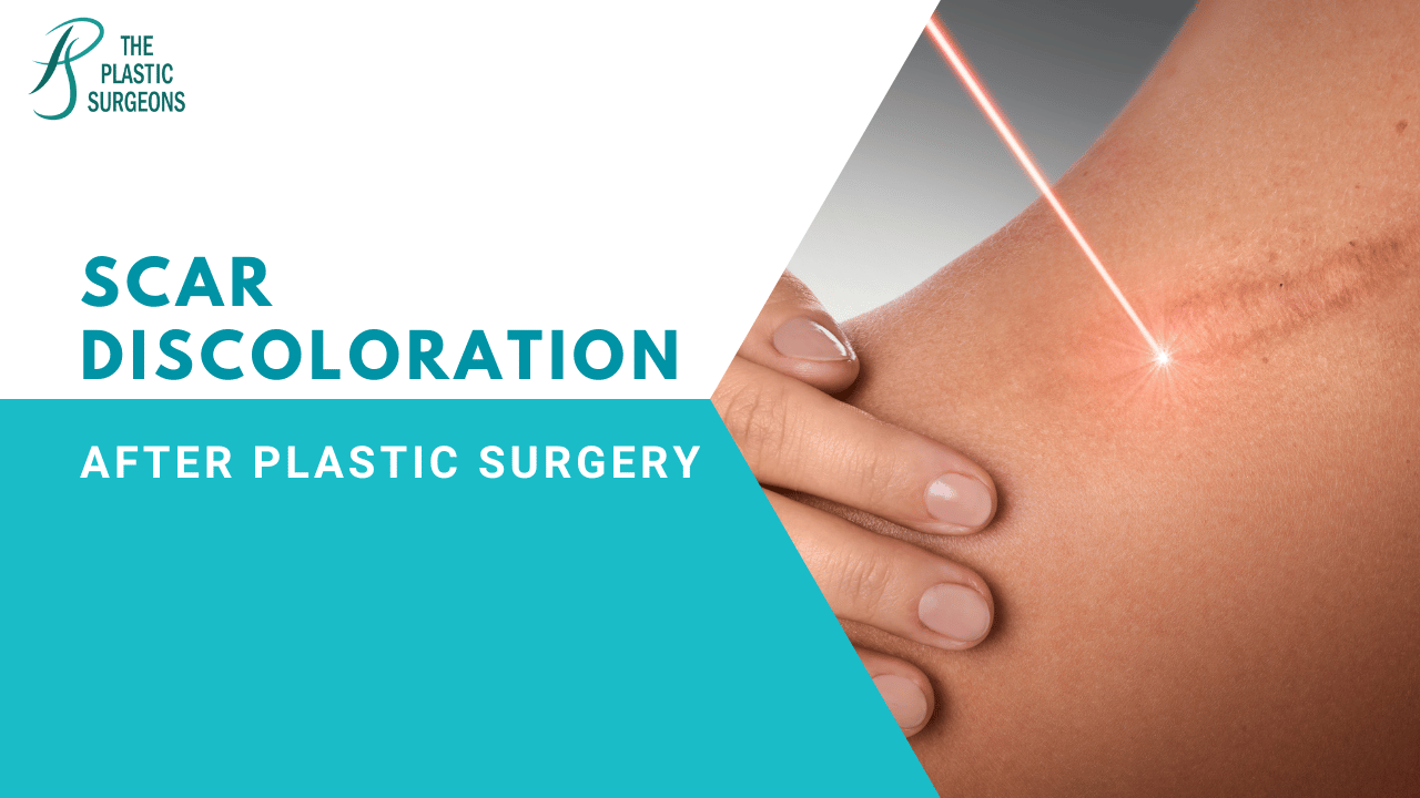 Understanding scar discoloration after plastic surgery