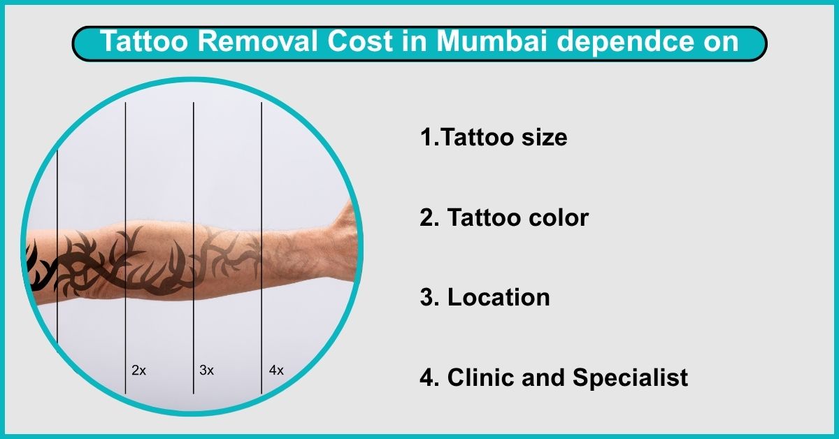 How Much Does Tattoo Removal Cost in Mumbai?