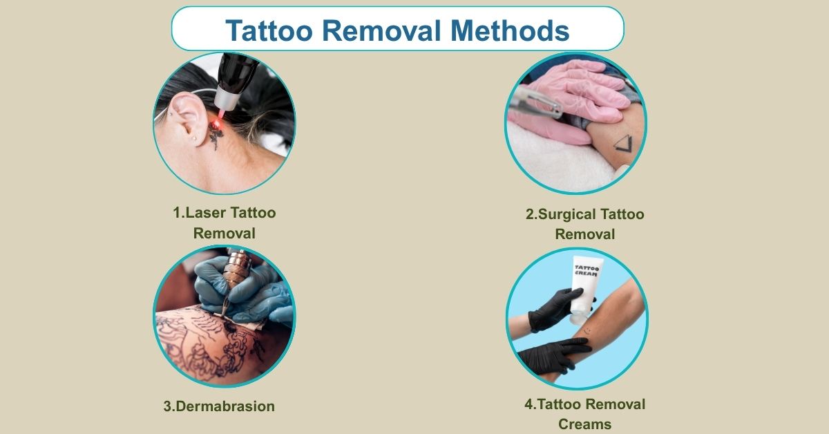 Understanding Tattoo Removal Methods