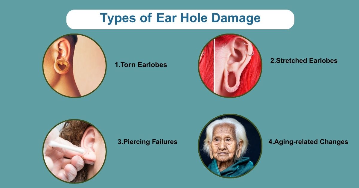 Types of Ear Hole Damage