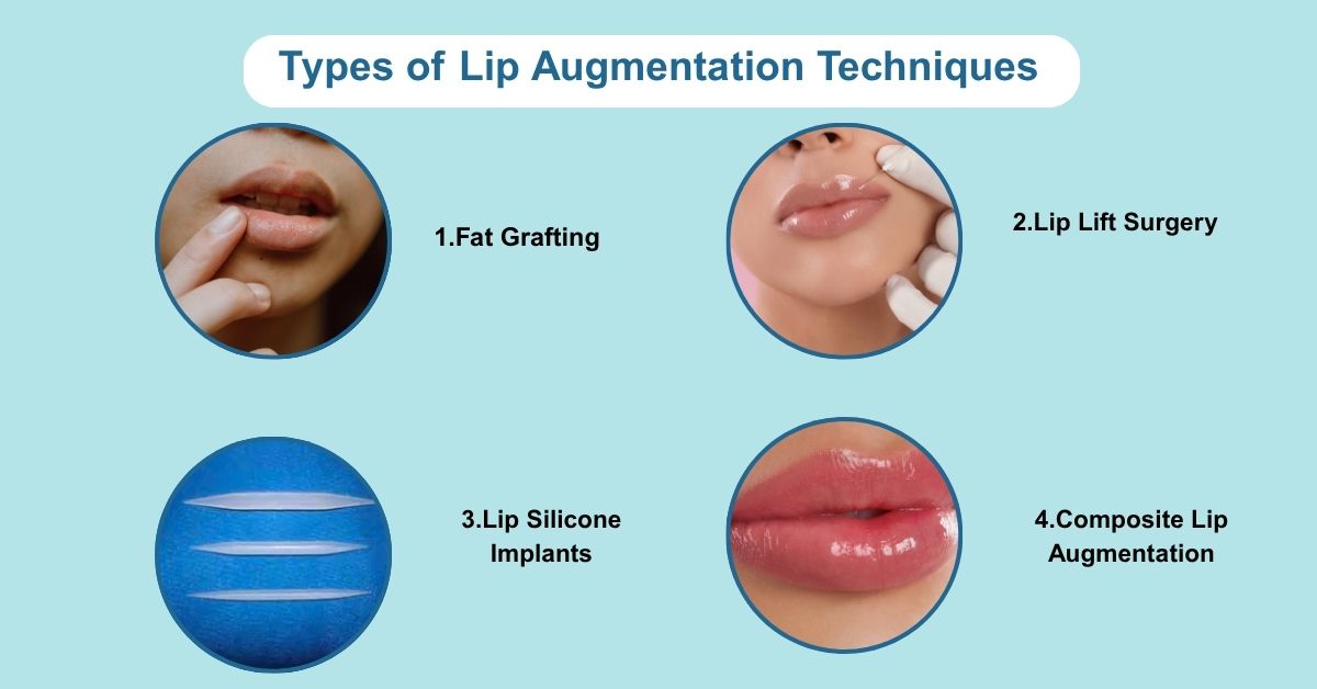 Types of Natural Lip Augmentation Techniques
