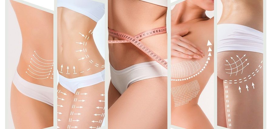 Who is an Ideal Candidate for Body Lift Surgery?