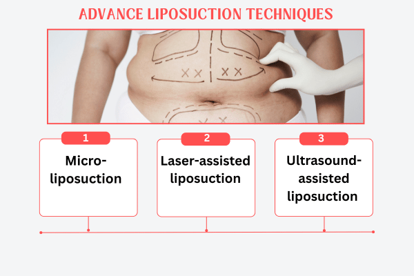 Advance Liposuction Techniques in Mumbai