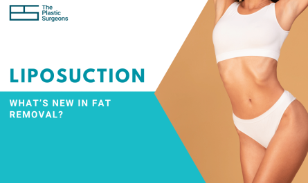 Liposuction Trends 2025: What’s New in Fat Removal?