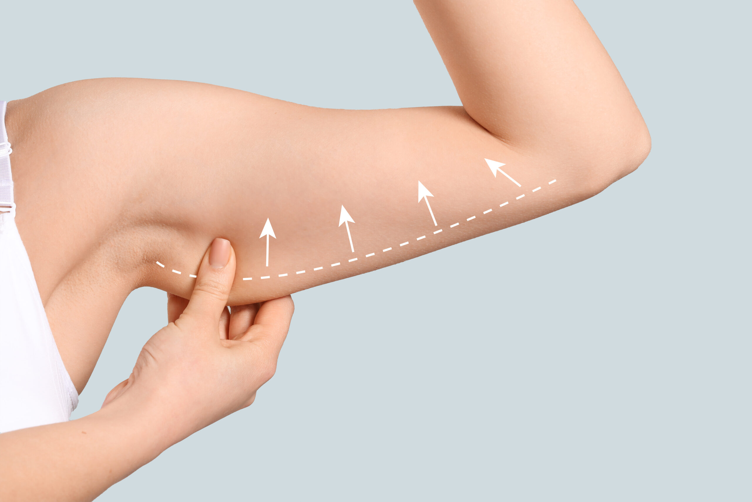 Advanced Arm lift Techniques in 2025
