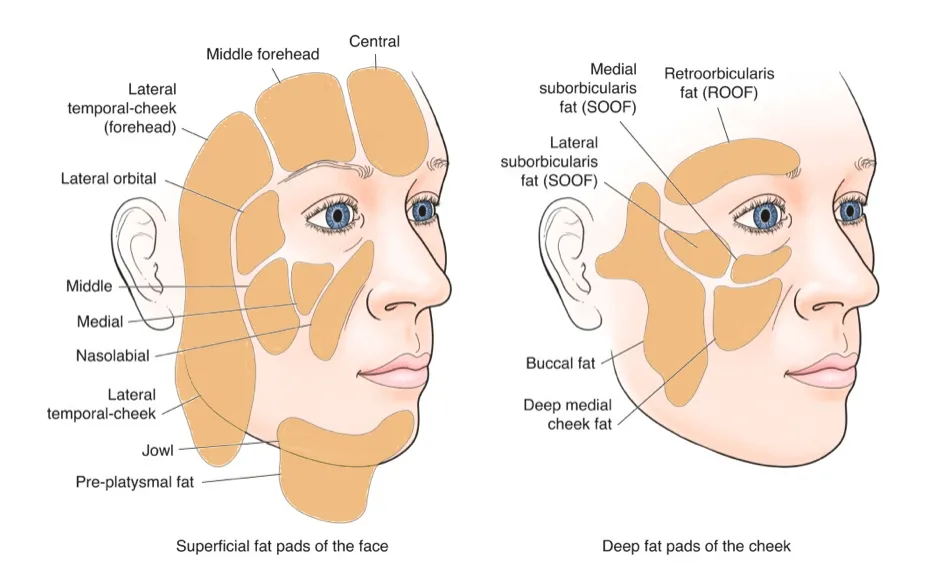 Key Benefits of Facial Fat Grafting