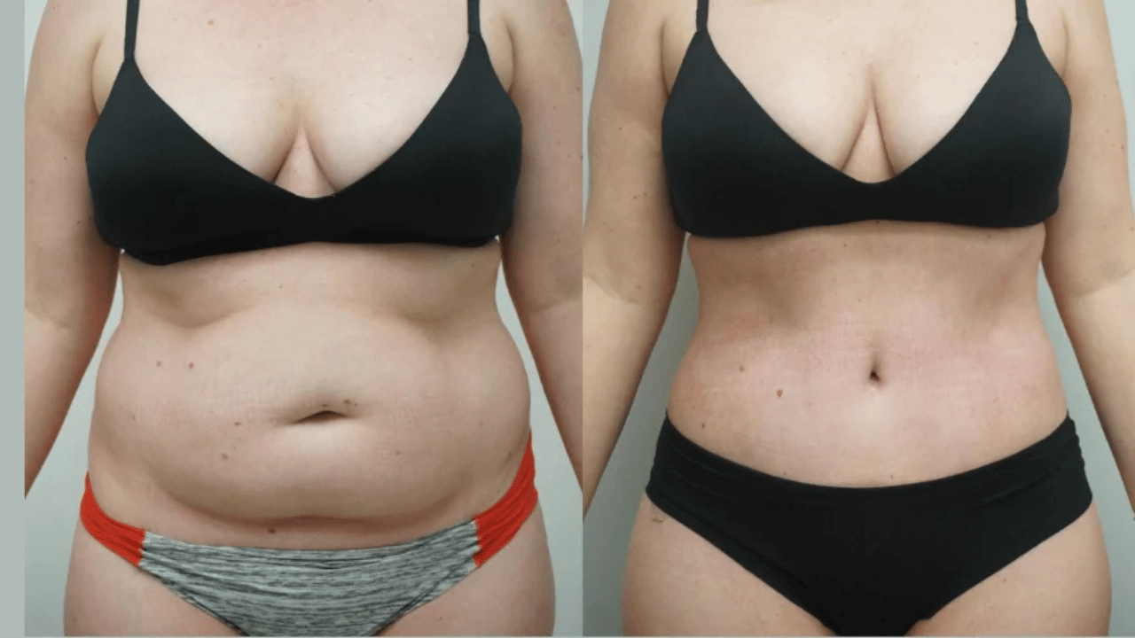 Choosing the Right Surgeon in Mumbai