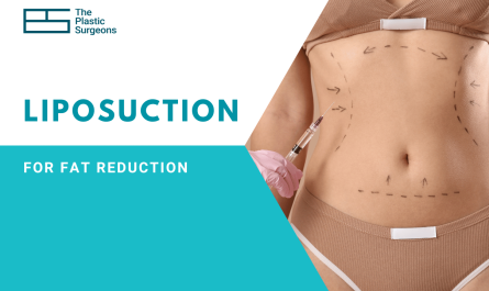 Liposuction for Fat Reduction Cost In Mumbai
