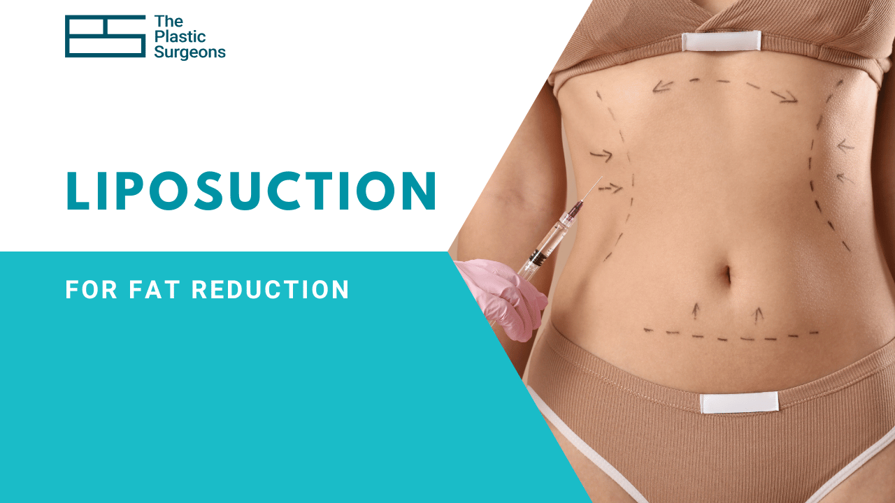 Liposuction for Fat Reduction Cost In Mumbai