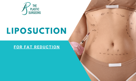 Liposuction for Fat Reduction Cost In Mumbai