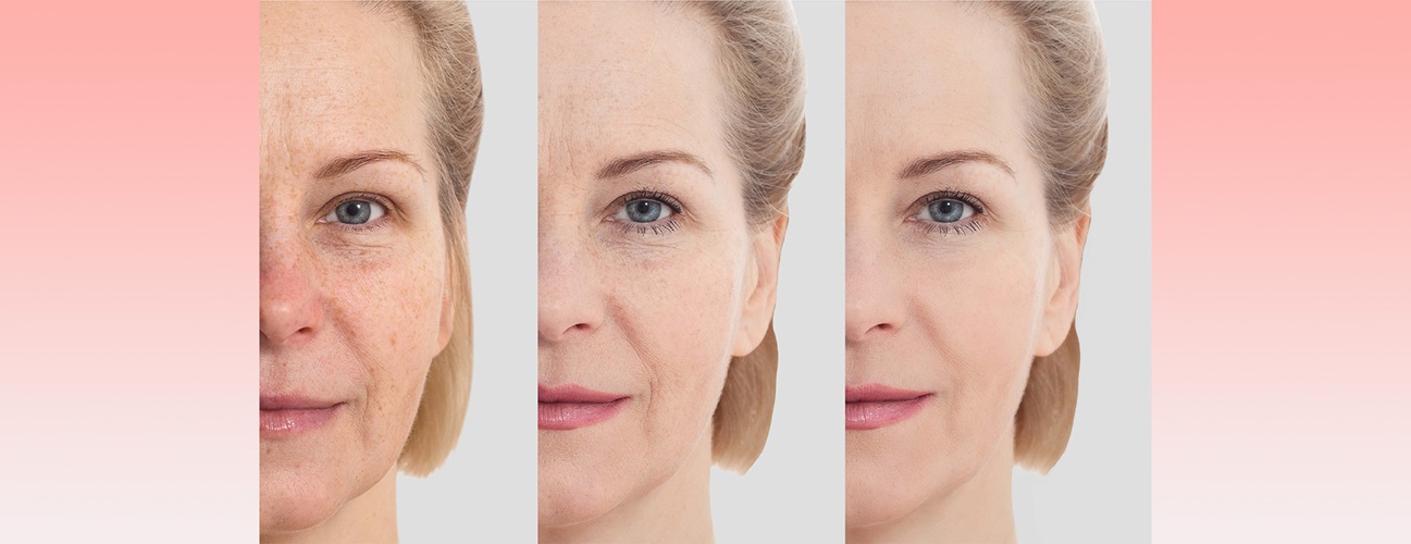 Surgical Face Rejuvenation Techniques