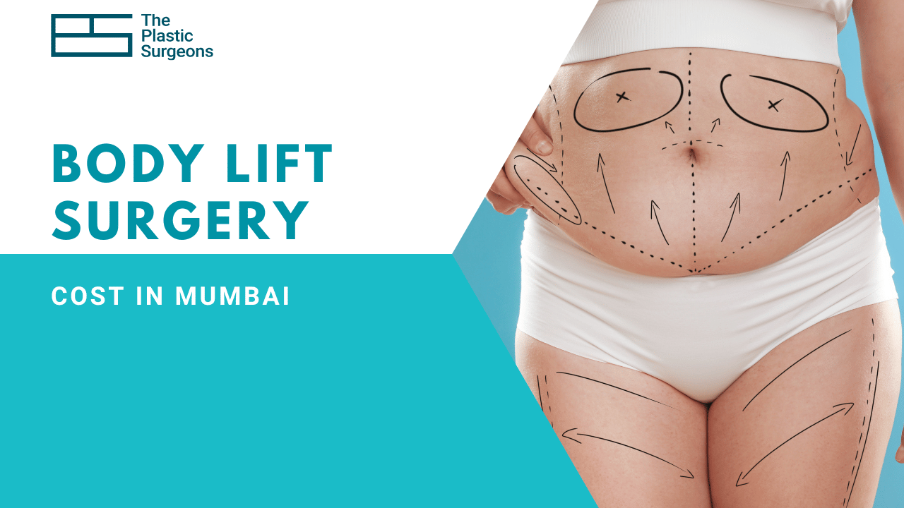 Cost of Body Lift Surgery in Mumbai: Factors and Insights