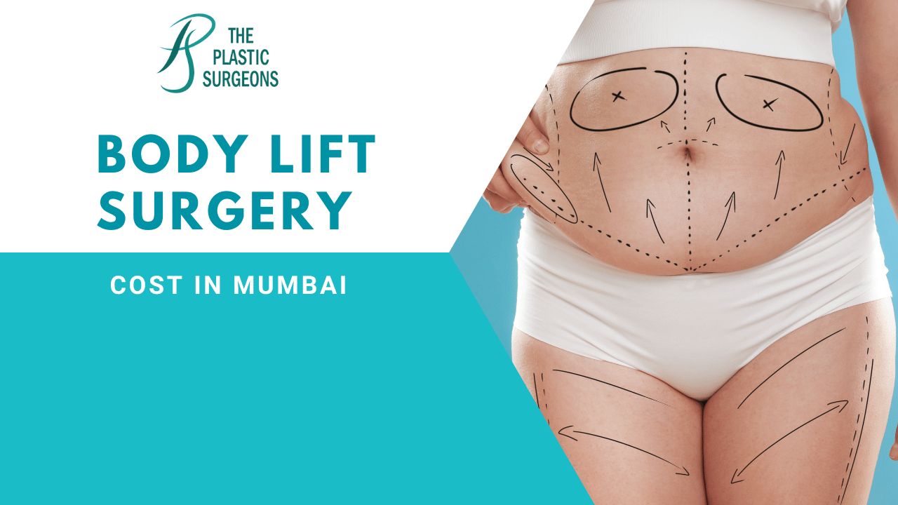 Cost of Body Lift Surgery in Mumbai: Factors and Insights