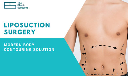 Liposuction Surgery: The Modern Body Contouring Solution