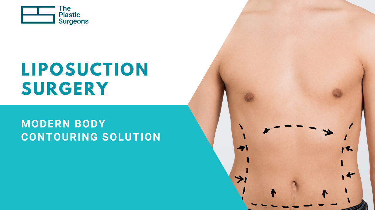 Liposuction Surgery: The Modern Body Contouring Solution