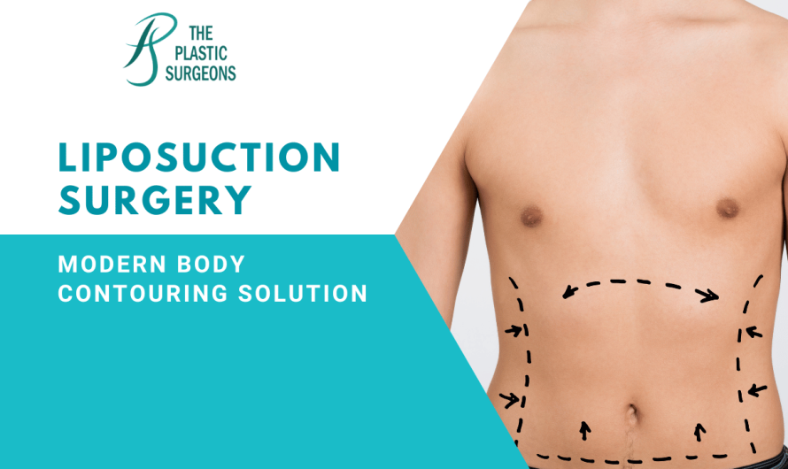 Liposuction Surgery: The Modern Body Contouring Solution
