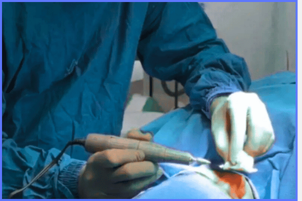 How to Choose the Right Surgeon for Dimplasty