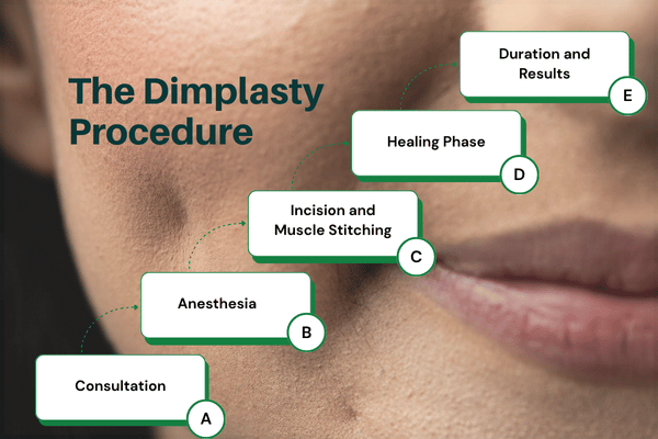 The Dimplasty Procedure