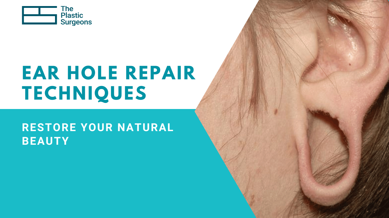 The Best Ear Hole Repair Techniques: Restore Your Natural Beauty