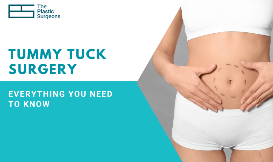 Is Tummy Tuck Surgery Right for Me? Everything You Need to Know